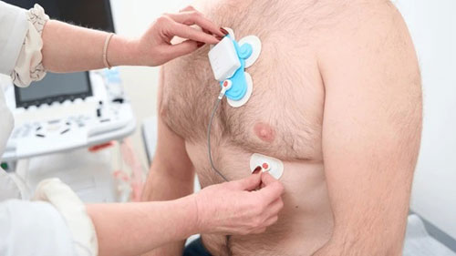 Holter Monitoring